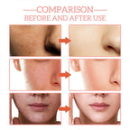 5-in-1 Fade Fine Lines Firming Face Serum Moisturizing Brightening Vitamin C